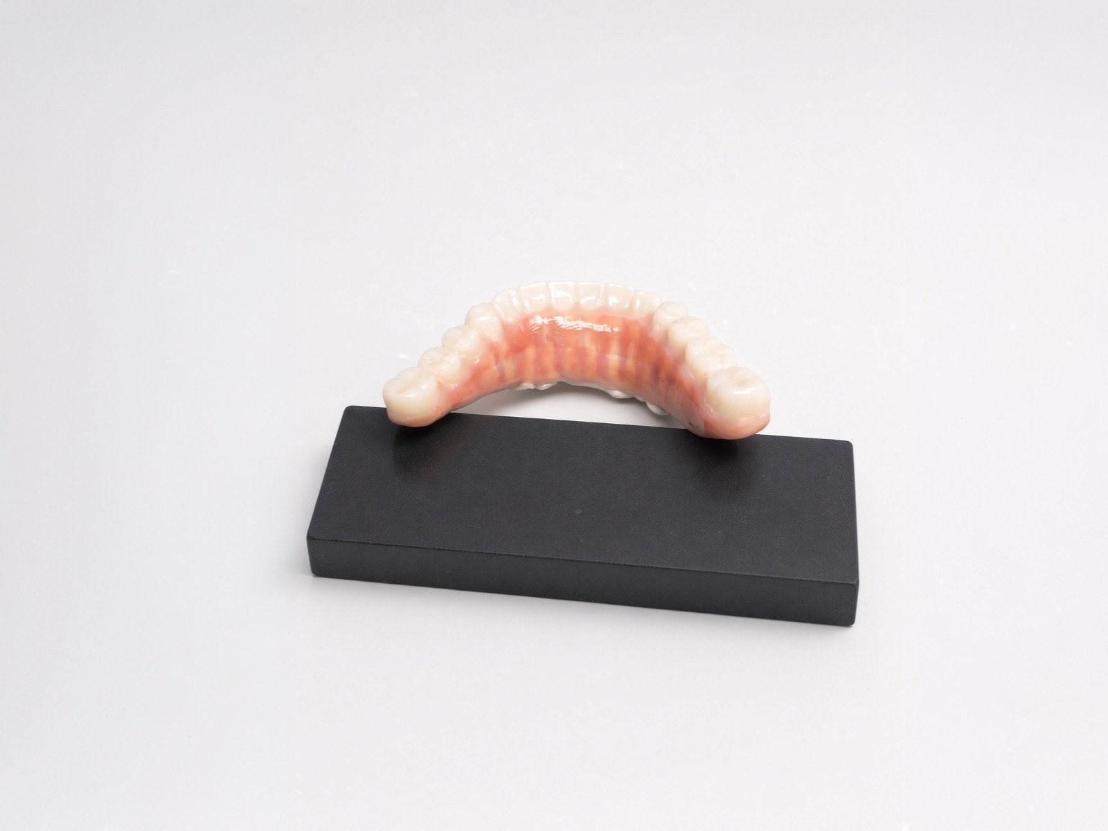 Toronto bridge — zirconia on a BioHPP base, finished with red-white aesthetics.